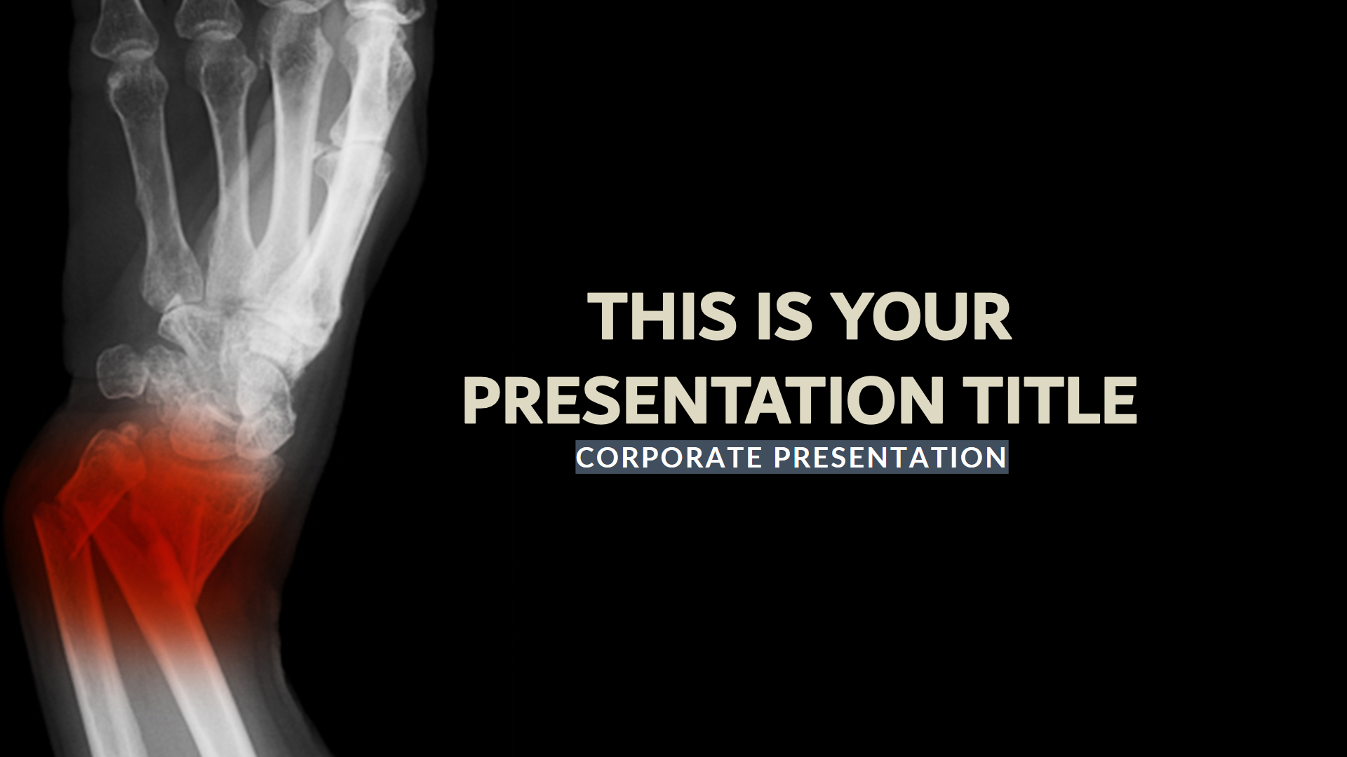 Broken Medical Free Presentation Template With Regard To Radiology Powerpoint Template
